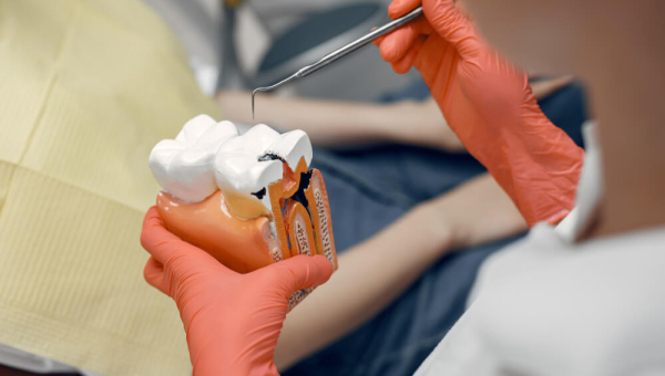 Bahaya Gigi Berlubang dan Cara Mengatasinya